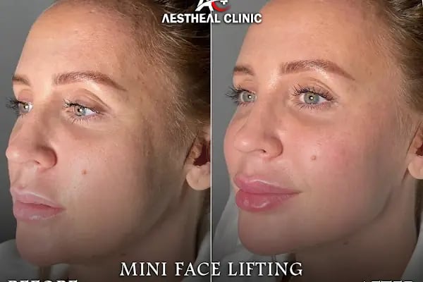 AESTHEAL CLİNİC - Resim 14