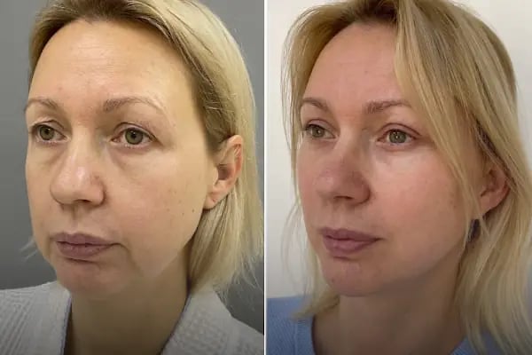 AESTHEAL CLİNİC - Resim 19