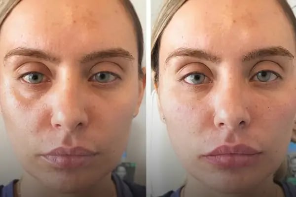 AESTHEAL CLİNİC - Resim 17