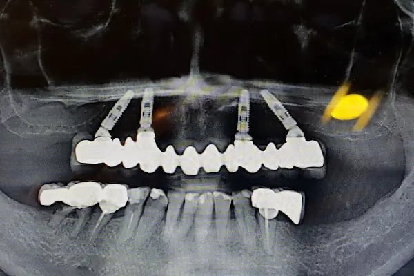 Zorlu Diş Polikliniği | Center Dental Clinic - Resim 10