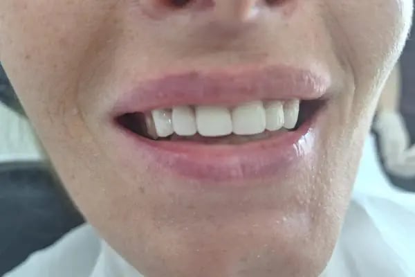 Zorlu Diş Polikliniği | Center Dental Clinic - Resim 20