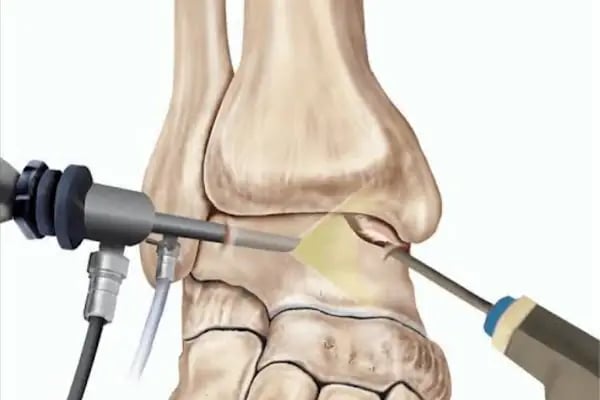 OP. DR. ÇETİN KÖSTEKCİ ORTOPEDİ EL MİKROCERRAHİ - Resim 3