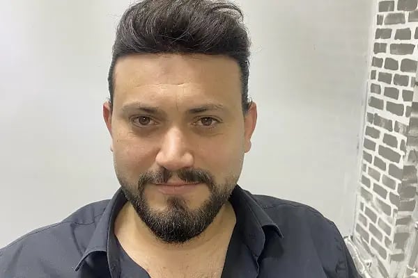 Arnavutköy Protez Saç Merkezi - Resim 10