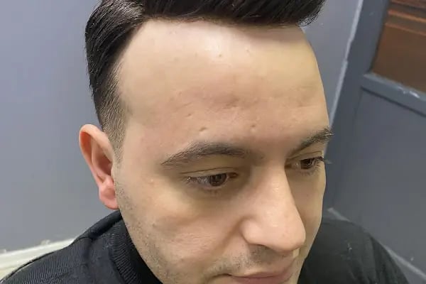 Arnavutköy Protez Saç Merkezi - Resim 13