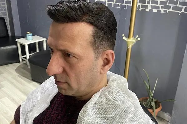 Arnavutköy Protez Saç Merkezi - Resim 14