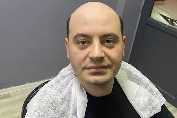 Arnavutköy Protez Saç Merkezi - Resim 8