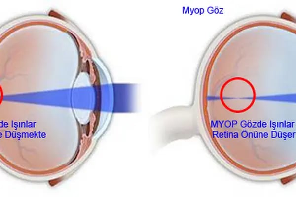 Elif Optik Aliağa - Resim 5