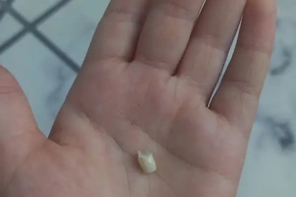 Çayırova Özel Marmara Diş Ağız ve Diş Sağlığı Polikliniği - Resim 5