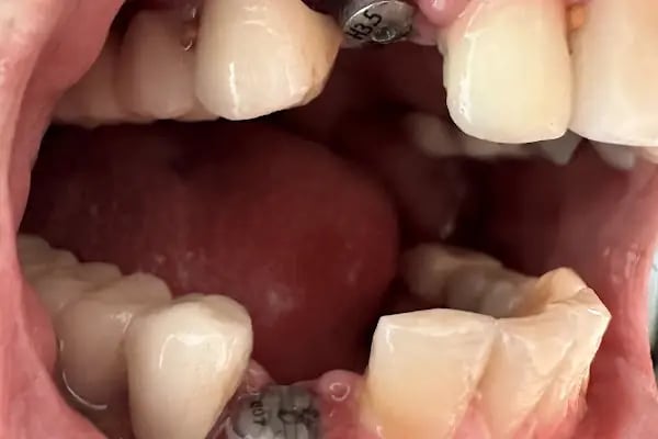 Özel Atalya Ağız ve Diş Sağlığı Polikliniği - Resim 12