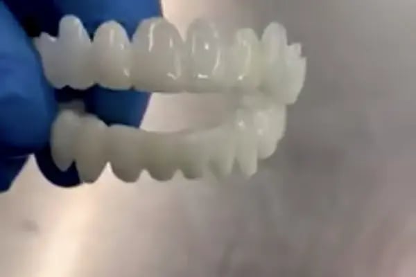 Özel Pursaklar Ağız Ve Diş Sağlığı Polikliniği - Resim 3