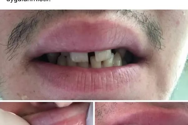 Özel Pursaklar Ağız Ve Diş Sağlığı Polikliniği - Resim 13